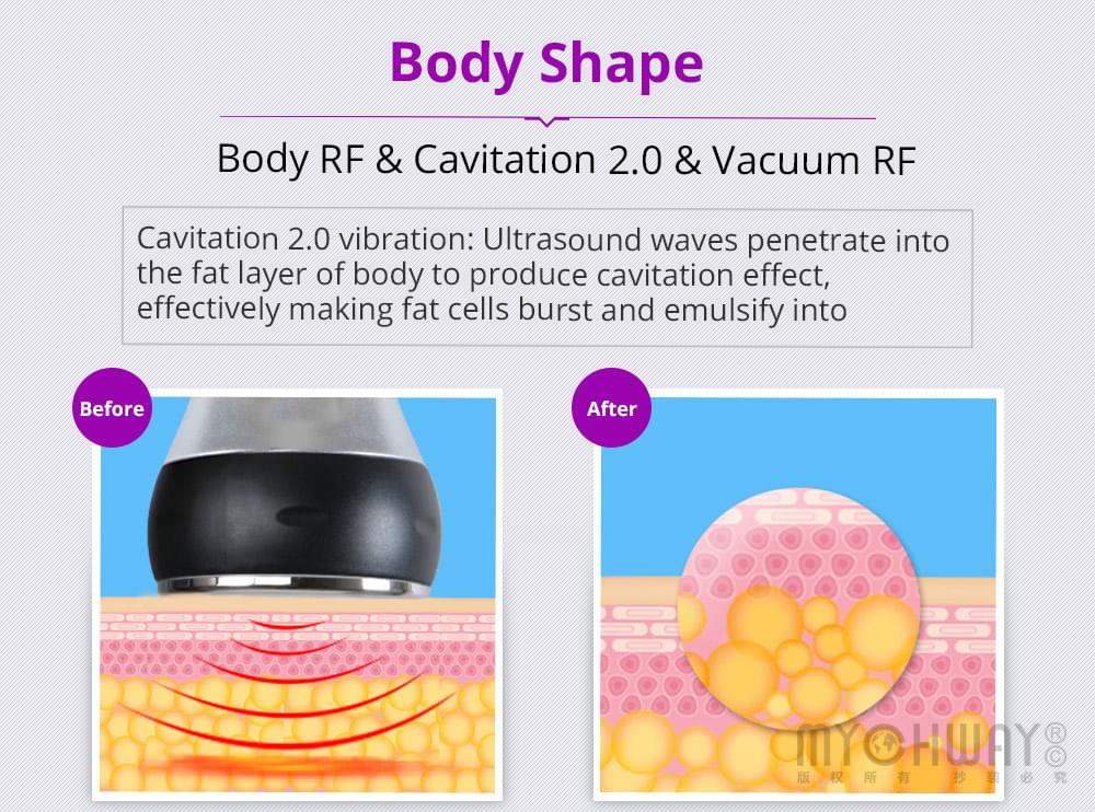 Cavitation RF Slimming Machine